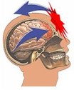 head diagram